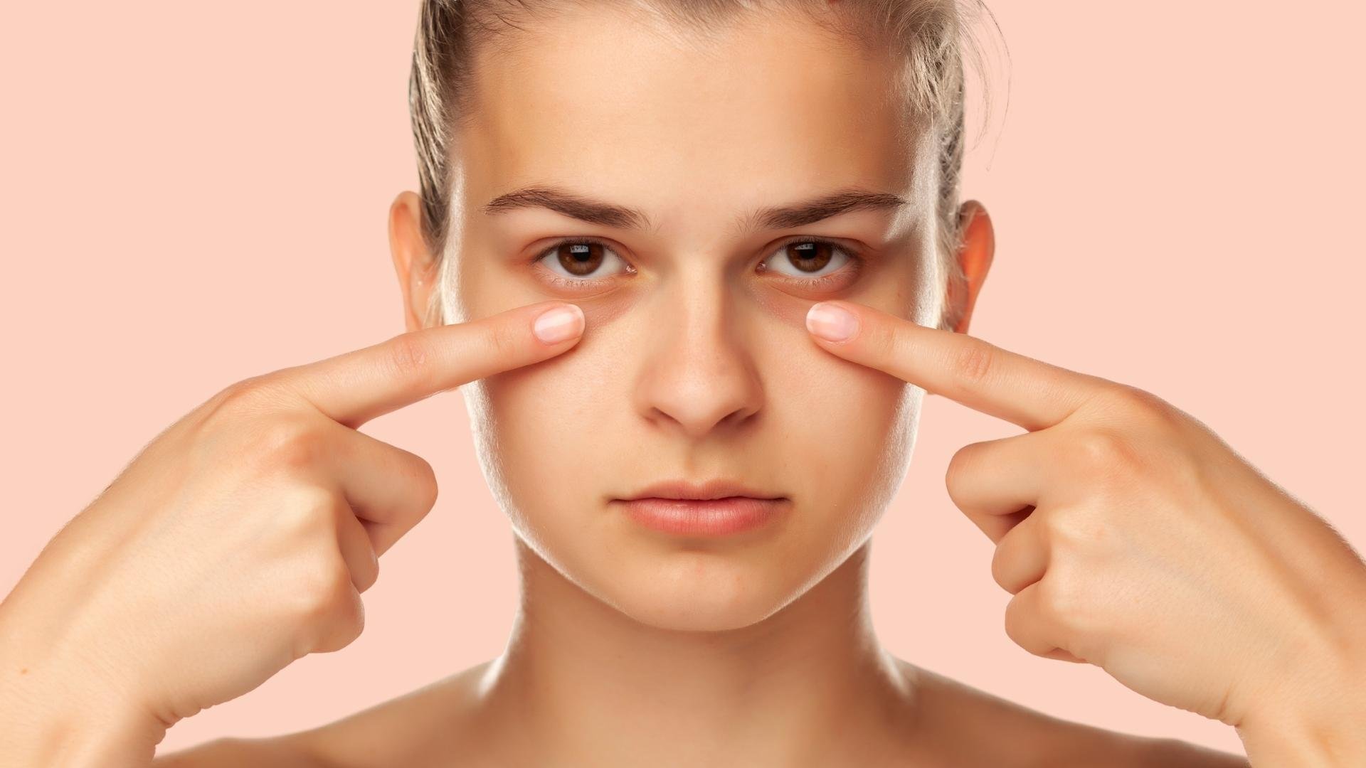 How To Get Rid Of Dark Circles Products? A Detailed Guide